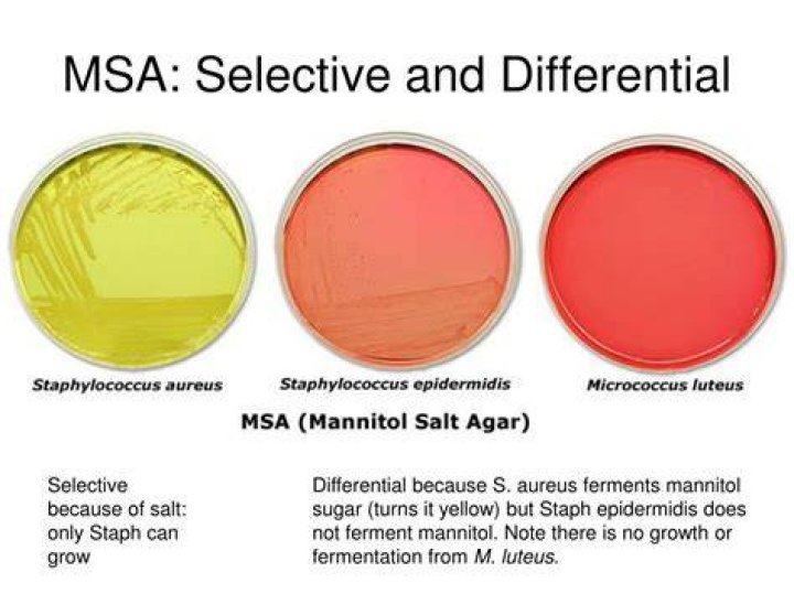 Can E coli grow on MSA