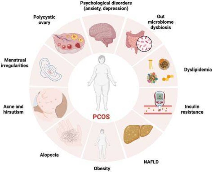 Can PCOS lead to death