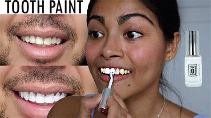 Can u paint your teeth