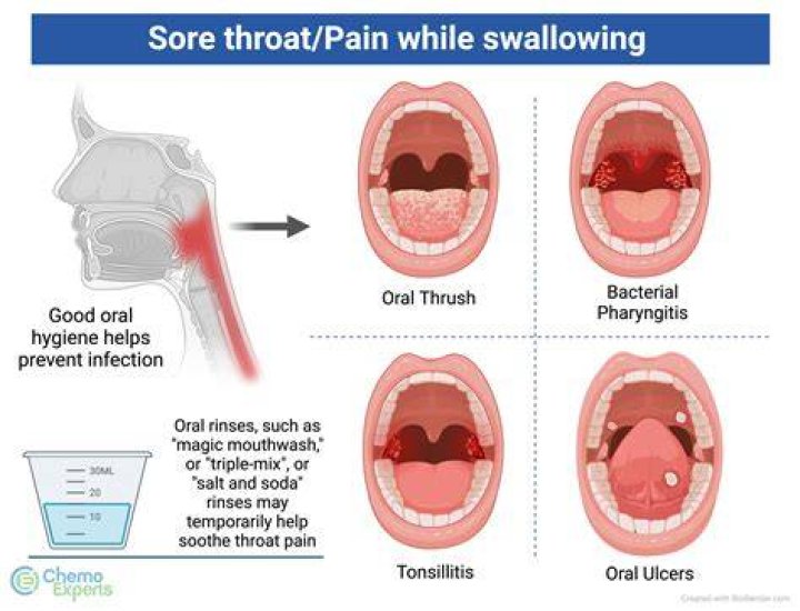 Does cold medicine help a sore throat