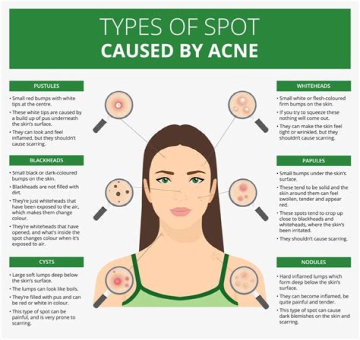 How deep is a spot face
