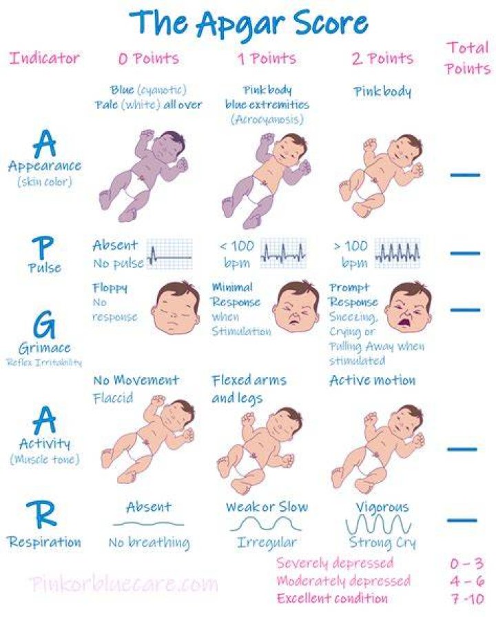 What does an Apgar score of 8 mean