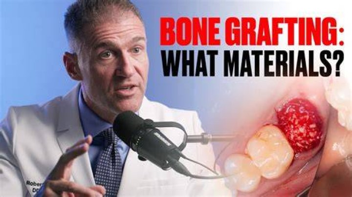 Which bone grafting material is the best